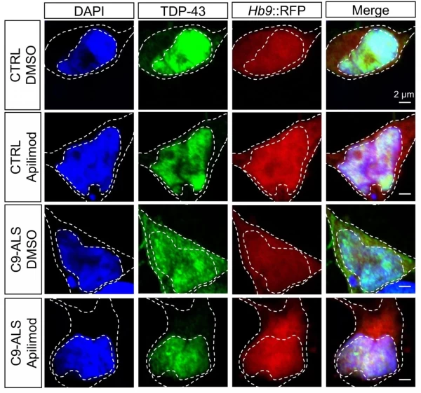TDP43-localization-in-iMNs-with-PIKFYVE-inhibitor-1-1440x1346